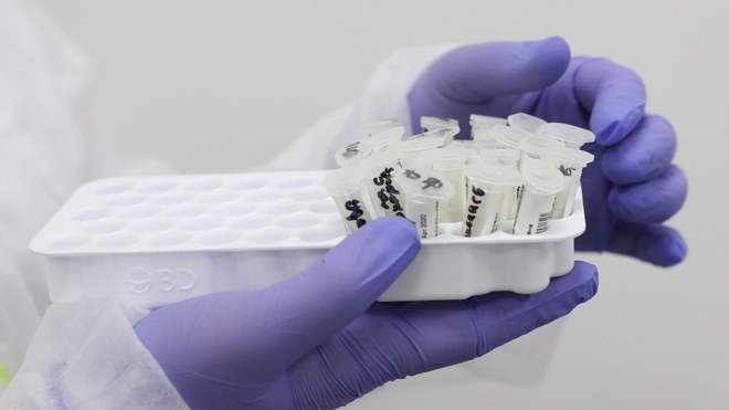 Israel crea anticuerpo para combatir al virus Sars CoV 2